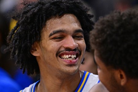 UCLA basketball player Skyy Clark smiles with a broken tooth